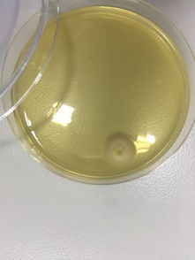 霉菌與食品微生物檢測(cè) Discuz技術(shù)平臺(tái)在微生物檢測(cè)中的應(yīng)用與前景